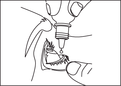 Goccia che cade da un flacone su un occhio aperto con una palpebra inferiore abbassata e ciglia visibili