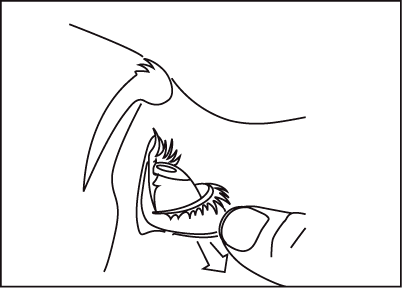 Ago curvo che penetra in un vaso sanguigno con una valvola cardiaca visibile all