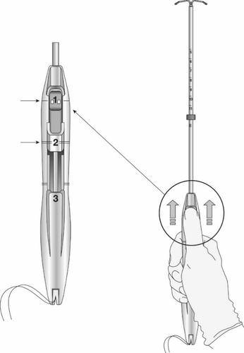 Dispositivo medico a forma di penna con indicatore numerico e pulsante di rilascio, tenuto in mano con frecce che indicano la pressione