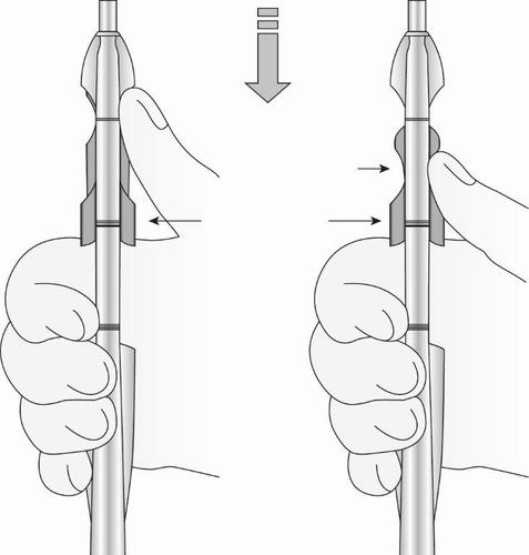 Mano che tiene un dispositivo medico cilindrico con due anelli neri e frecce che indicano la direzione di pressione