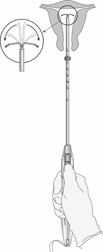 Dispositivo autoiniettante con ago visibile e ingrandimento del meccanismo a spirale per l