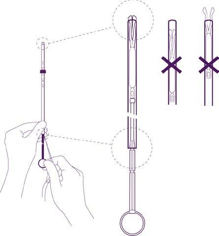 Siringa preriempita con stantuffo retrattile e meccanismo di sicurezza evidenziato con frecce e sezioni trasversali