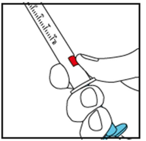 Siringa con ago rosso che inietta farmaco in una zona blu del braccio tenuta da una mano guantata bianca