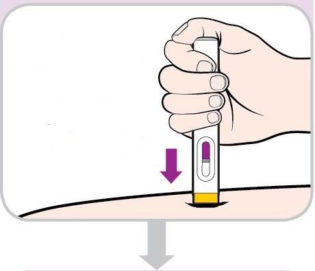 Mano che preme un dispositivo autoiniettante sulla pelle con freccia viola che indica la direzione di iniezione