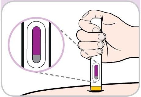 Mano che tiene un dispositivo per iniezione con ago, dettaglio ingrandito del meccanismo interno e zona di iniezione sulla pelle