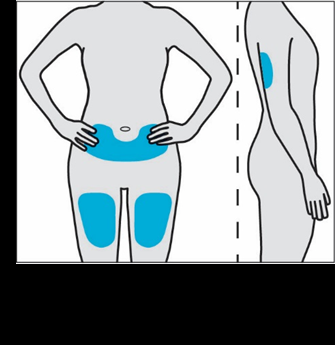 Schema del corpo umano con evidenziate in blu le aree consigliate per l