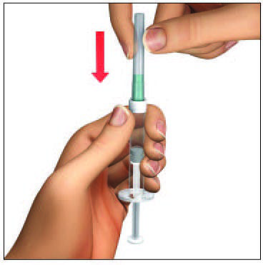 Mano che tiene una siringa preriempita con liquido trasparente e verde, freccia rossa indica la direzione di inserimento