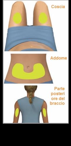 Corpo umano con evidenziate in giallo le zone di iniezione: coscia, addome e parte posteriore del braccio