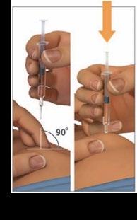Mano che tiene una siringa, ago inserito nella pelle con angolo di 90 gradi, freccia che indica la direzione dell