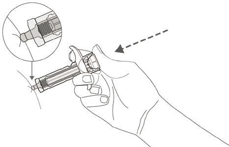 Mano che tiene un dispositivo medico con connettore a baionetta e freccia che indica il movimento di inserimento