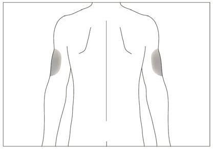 Schema del corpo umano con evidenziate in grigio le aree del deltoide per l