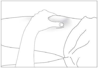 Mano che stringe una siringa con ago inserito nella pelle del braccio, area di iniezione evidenziata in grigio chiaro