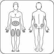 Schema corporeo con aree ombreggiate che indicano possibili siti di iniezione sottocutanea addome fianchi e cosce