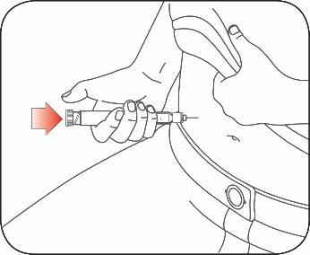 Mano che tiene una penna iniettabile con ago inserito nella piega cutanea, freccia rossa indica la direzione