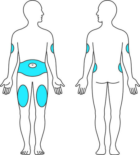 Corpo umano stilizzato visto frontalmente e posteriormente con aree evidenziate in blu per iniezioni intramuscolari coscia e gluteo