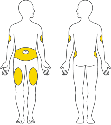 Due figure umane schematiche con aree evidenziate in giallo su fianchi, cosce e addome per indicare siti di iniezione