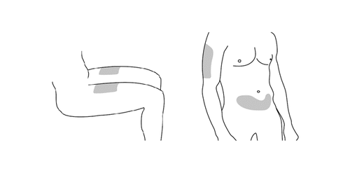 Schizzo di torso e braccio umano con aree ombreggiate che indicano possibili siti di iniezione sottocutanea o intramuscolare