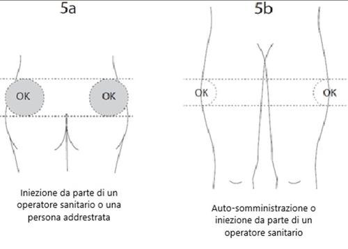 Quattro schemi di iniezione sottocutanea con frecce e cerchi OK, uno mostra l