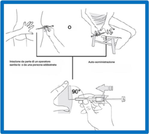 Iniezione sottocutanea con penna precompilata a 90 gradi, mani che guidano il dispositivo e indicazione dell