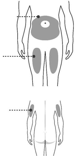 Schema del corpo umano con aree grigie che indicano siti di iniezione sottocutanea addome fianchi e cosce