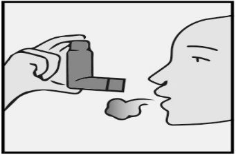 Mano che tiene un inalatore vicino alla bocca del paziente con emissione di un getto di farmaco visibile