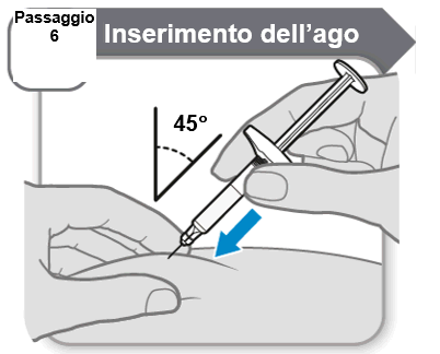 Mano che inserisce un ago in un braccio con un angolo di 45 gradi indicato da una linea e un valore numerico freccia blu indica la direzione