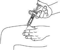 Mano che tiene una siringa inclinata, ago inserito nella pelle di un braccio, tecnica di iniezione sottocutanea illustrata con linee semplici