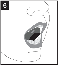 Bocca aperta con lingua in posizione e un rettangolo nero che rappresenta un farmaco sublinguale posizionato sotto la lingua