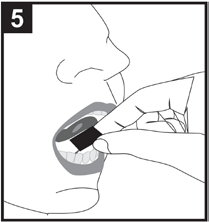 Mano che inserisce un dispositivo ovale scuro tra le labbra e i denti inferiori e superiori