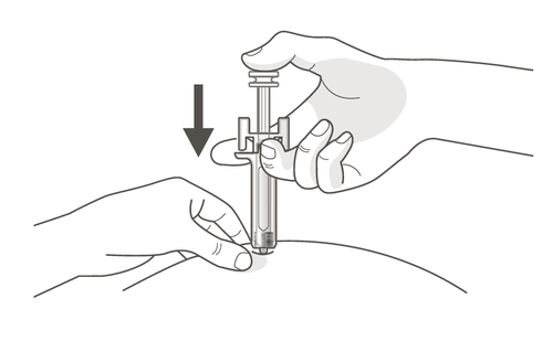 Mano che tiene una siringa preriempita con ago inserito nella pelle del braccio, freccia nera indica la direzione di iniezione