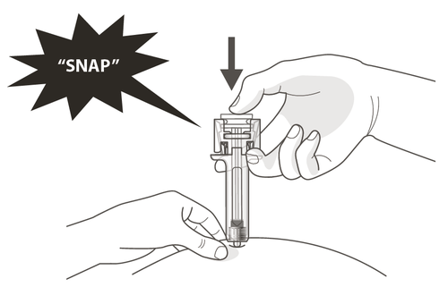 Mano che preme un autoiniettore sulla coscia con un suono "SNAP" indicato da un