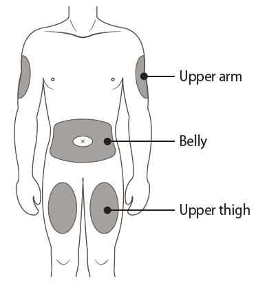Schema del corpo umano con aree ombreggiate per iniezione: braccia, addome e cosce superiori indicate con frecce