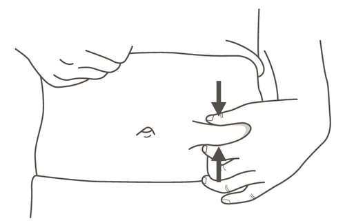 Mano che pizzica la pelle e introduce un ago sottocutaneo con una leggera piega cutanea e freccia direzionale