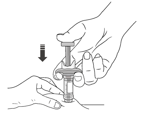 Mano che preme un dispositivo autoiniettante con ago rivolto verso il basso su una superficie cutanea simulata