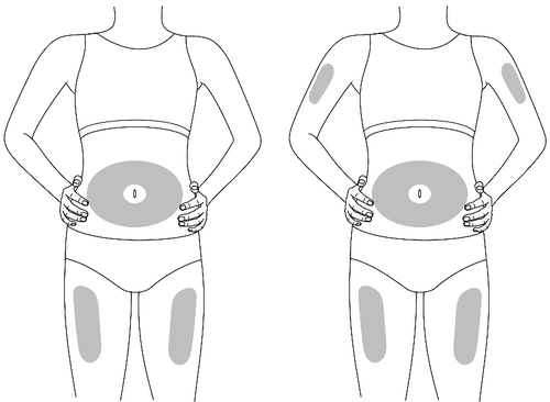 Due figure femminili mostrano aree di applicazione del cerotto medicamentoso su addome, fianchi e glutei