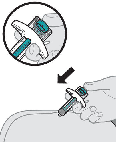 Dispositivo autoiniettante con ago esposto premuto sulla pelle da una mano con freccia indicante la direzione
