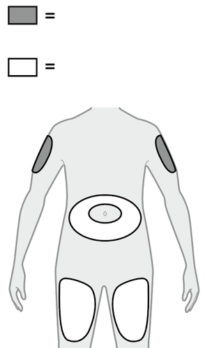 Schema del corpo umano con aree evidenziate per iniezioni sottocutanee su spalle, fianchi e addome