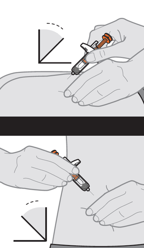 Mano che tiene una siringa preriempita inclinata a 45 gradi per iniezione sottocutanea su pelle chiara con indicazione angolare