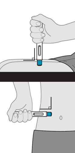 Mano che tiene un dispositivo per iniezione sottocutanea con ago inserito nella pelle addominale inclinata