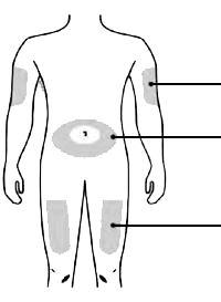 Schema del corpo umano con aree ombreggiate che indicano possibili siti di iniezione sottocutanea su braccia, cosce e addome