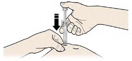 Mano che tiene una siringa preriempita con ago inserito nella pelle, freccia nera indica la direzione di iniezione sottocutanea