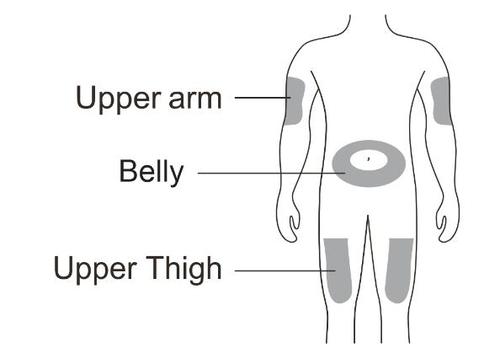 Schema del corpo umano con indicazioni delle aree di iniezione braccio superiore addome e coscia superiore