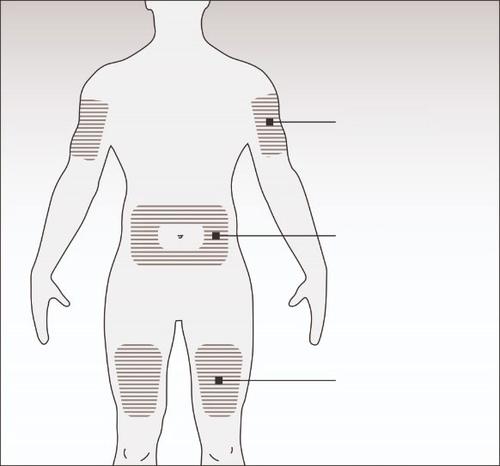Schema del corpo umano con aree ombreggiate per iniezioni sottocutanee su braccia, addome e cosce