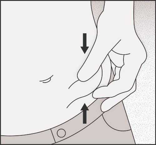 Mano che pizzica la pelle e forma una piega, frecce nere indicano la direzione del pizzicamento e del sollevamento cutaneo