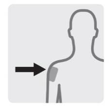 Profilo di una spalla e braccio con freccia nera che indica il punto di iniezione su un