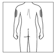 Schema del corpo umano con indicazione delle aree deltoidee per l