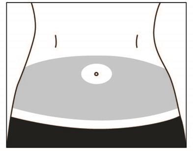 Addome con area grigia che indica il sito di iniezione e cerchio bianco con punto centrale per la precisa localizzazione