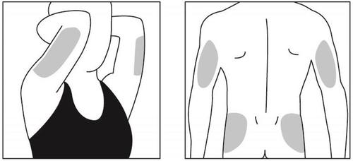 Schizzi di braccio e schiena umana con aree grigie che indicano i siti di iniezione intramuscolare consigliati