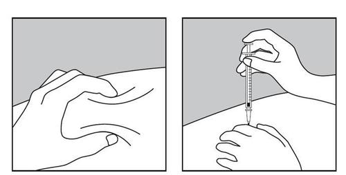 Mano che afferra una siringa verticale sopra la pelle, l