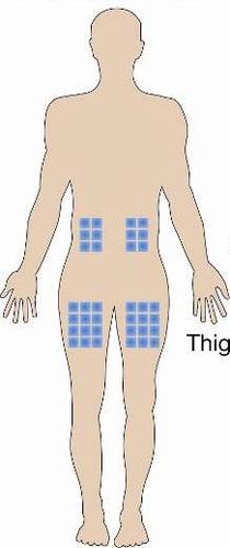 Schema corporeo umano con aree ombreggiate in blu che indicano possibili siti di iniezione nella coscia e nell